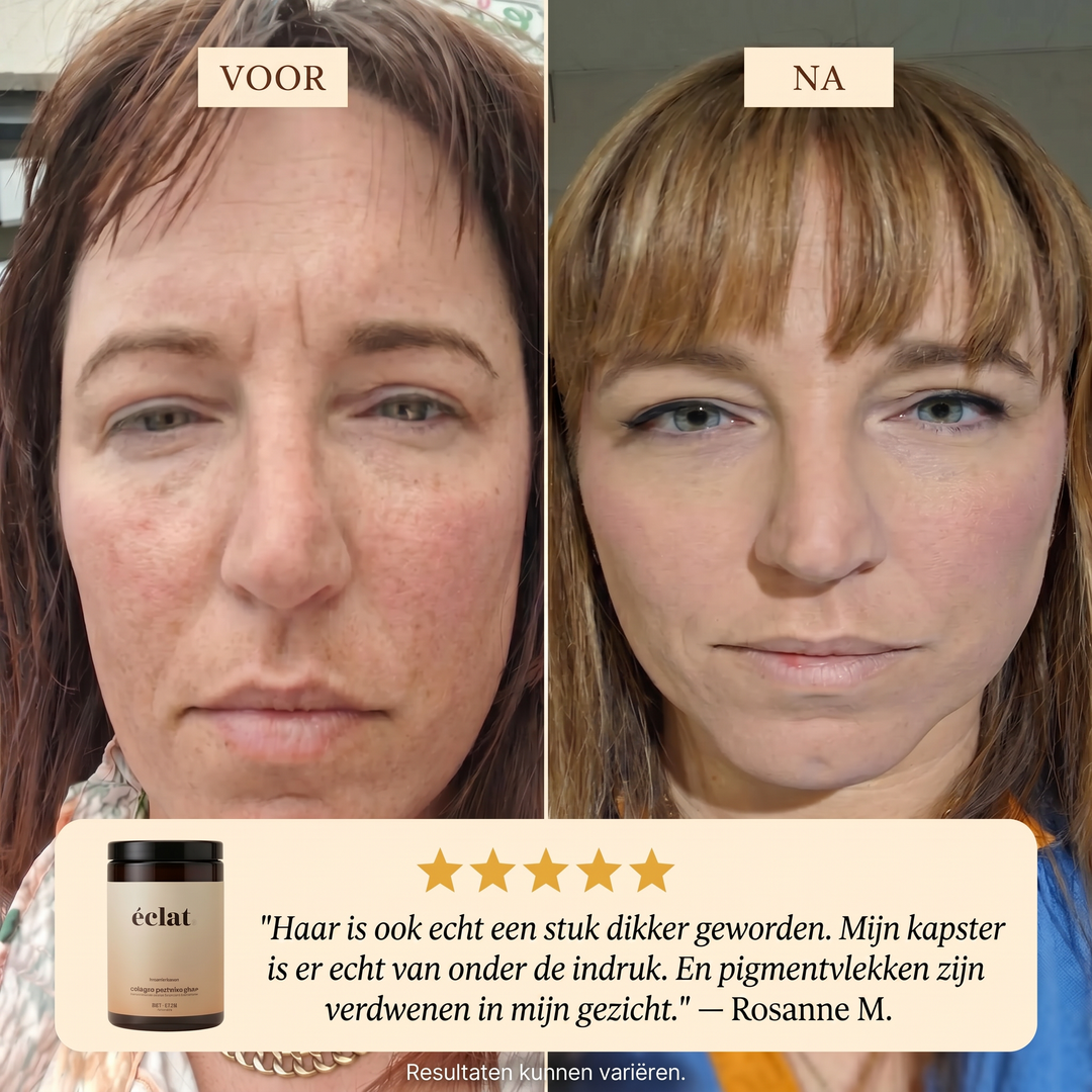 Collageen Peptides Plus+ (pot - 300 gram - 30 doseringen - bovine - tropical)